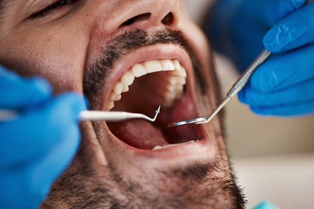 Best Emergency Root Canal Treatment in Brookside, NJ