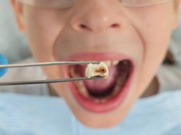 Best Emergency Treatment for Toothache in Brookside, NJ